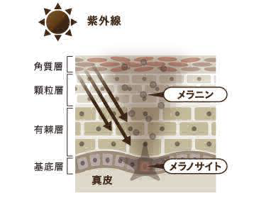 紫外線