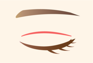eye_全切開
